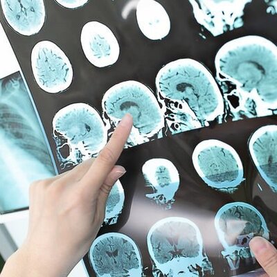 Korkunç! 2050 yılında 150 milyona ulaşacak!