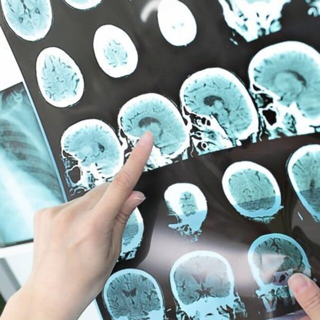 Korkunç! 2050 yılında 150 milyona ulaşacak!