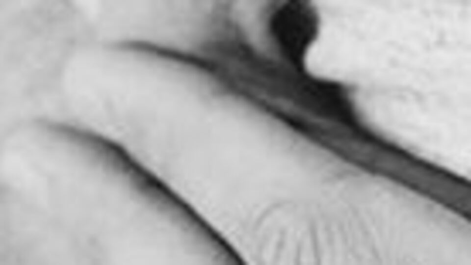 Aort yırtılmasında erken müdahale ölüm riskini azaltıyor