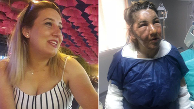 Cezaevinden izinli çıktı! Eski eşini yağ ile yaktı!