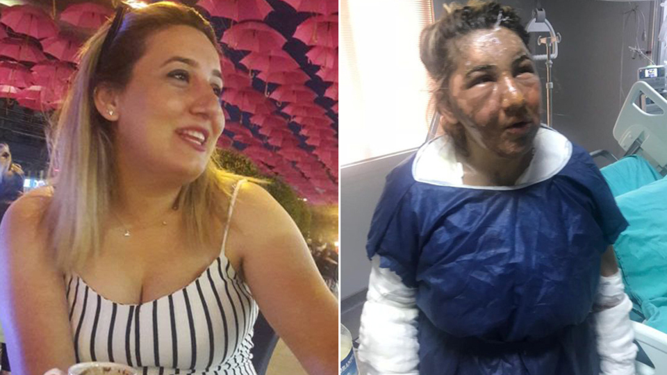 Cezaevinden izinli çıktı! Eski eşini yağ ile yaktı!