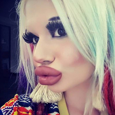 Tek isteği en büyük dudaklara sahip olmak!