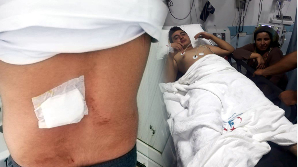 Feci olay! Damda uyurken kanlar içinde kaldı