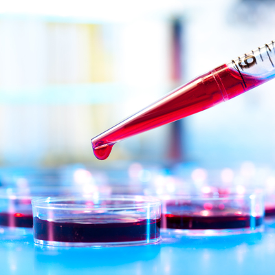 Mucize test! Tek kan testiyle 20 kanser türü tespit edilecek