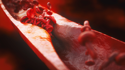 Kolesterol dost mu düşman mı?