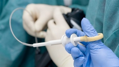 Endoskopi nasıl yapılır?