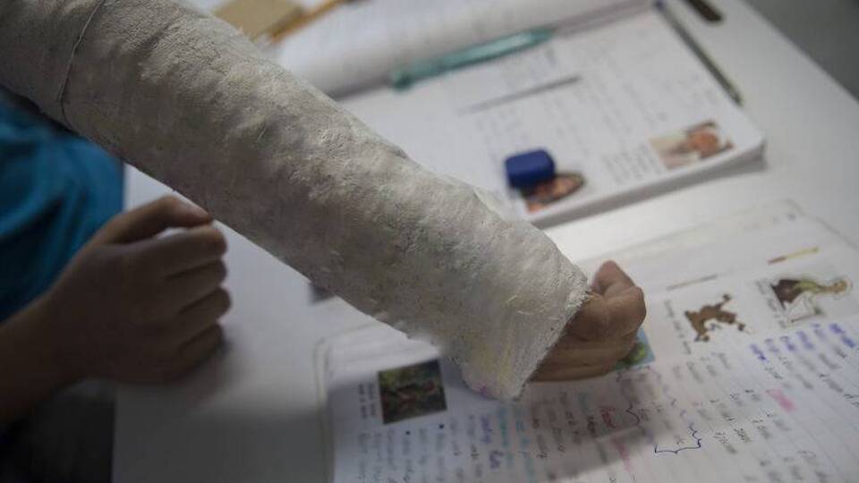 Kol kırığına alçı nasıl yapılır?