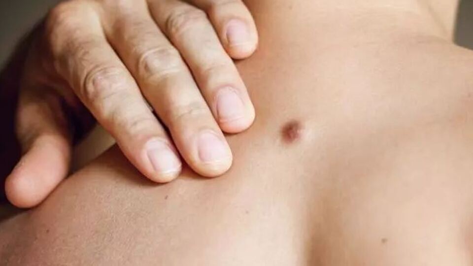 Çıban nasıl oluşur? Çıban nasıl geçer?