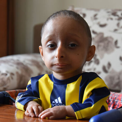 Sadece 4 kilo! Yaşını duyan inanamıyor!