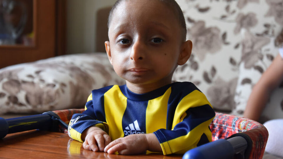 Sadece 4 kilo! Yaşını duyan inanamıyor!