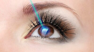 Lazerle Göz Ameliyatı