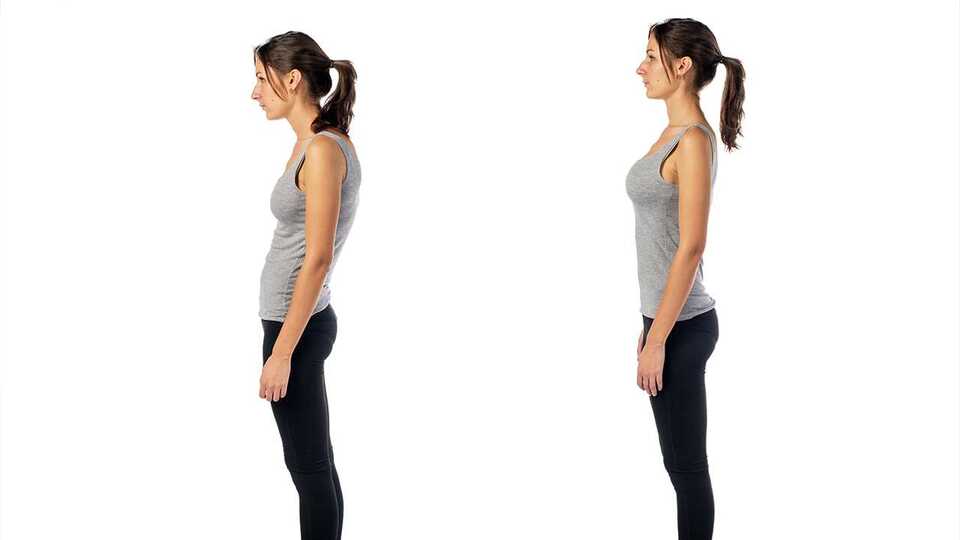 Kamburluk (Kifoz) nedir?