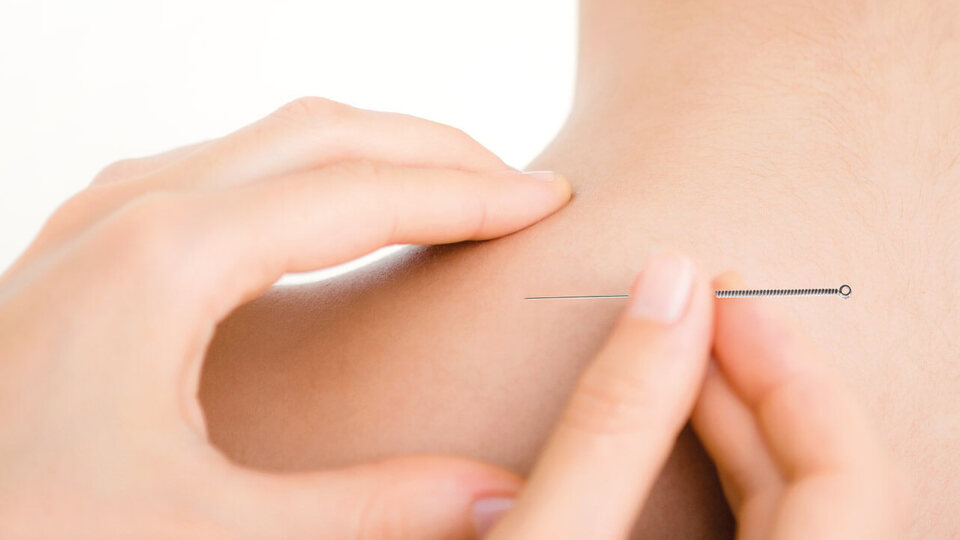 Kuru iğne tedavisi nasıl yapılır?