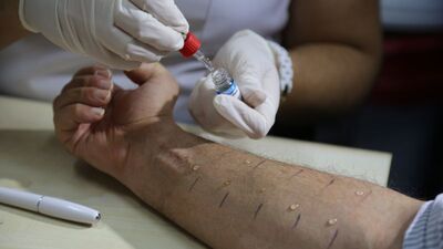 Bacaklarda kaşıntı neden olur?