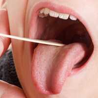 Bademcik şişmesine ne iyi gelir?