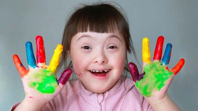 Mongolizm hastalığı (Down Sendromu) nasıl teşhis edilir?