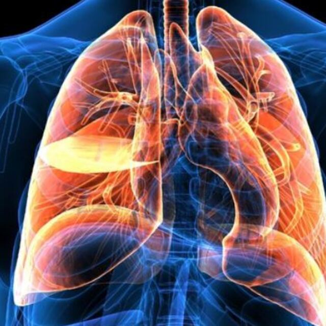 Akciğer kanserinin belirtileri!