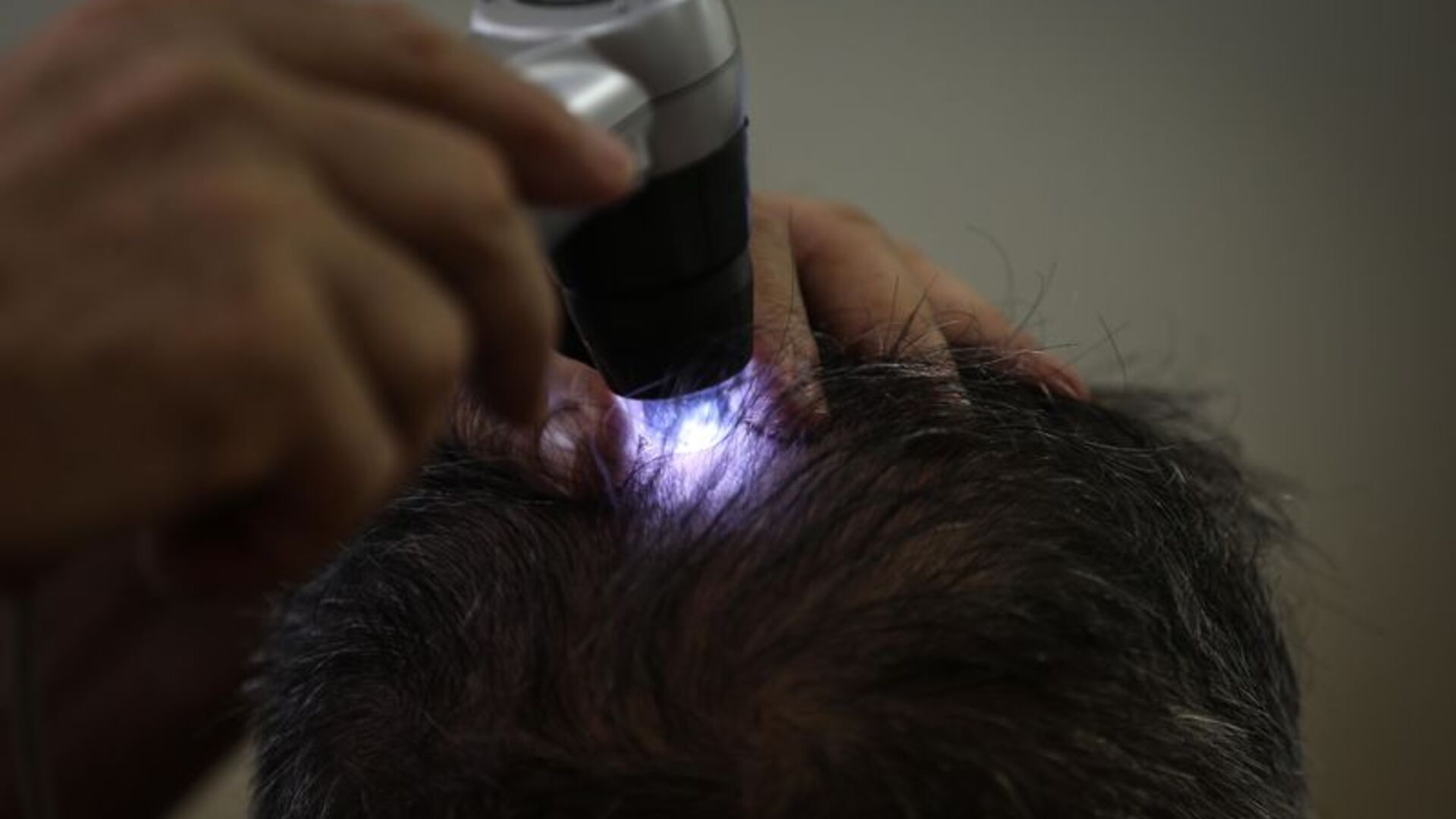 Saç dökülmesine ne iyi gelir? Evde iyi gelen şeyler nelerdir?