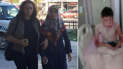 Komşularının üzerine asit dökmüştü!