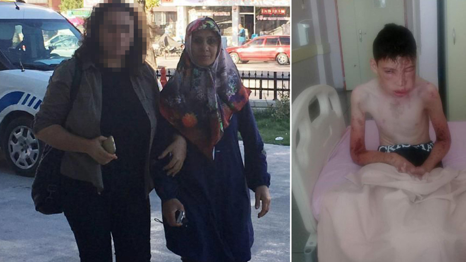 Komşularının üzerine asit dökmüştü!