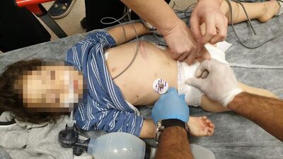 Kahrolduk! Vicdansızlar 'motosiklet kazası' dediler