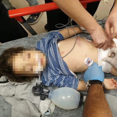 Kahrolduk! Vicdansızlar 'motosiklet kazası' dediler