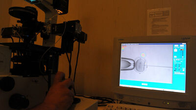 Mikroenjeksiyon nasıl yapılır?