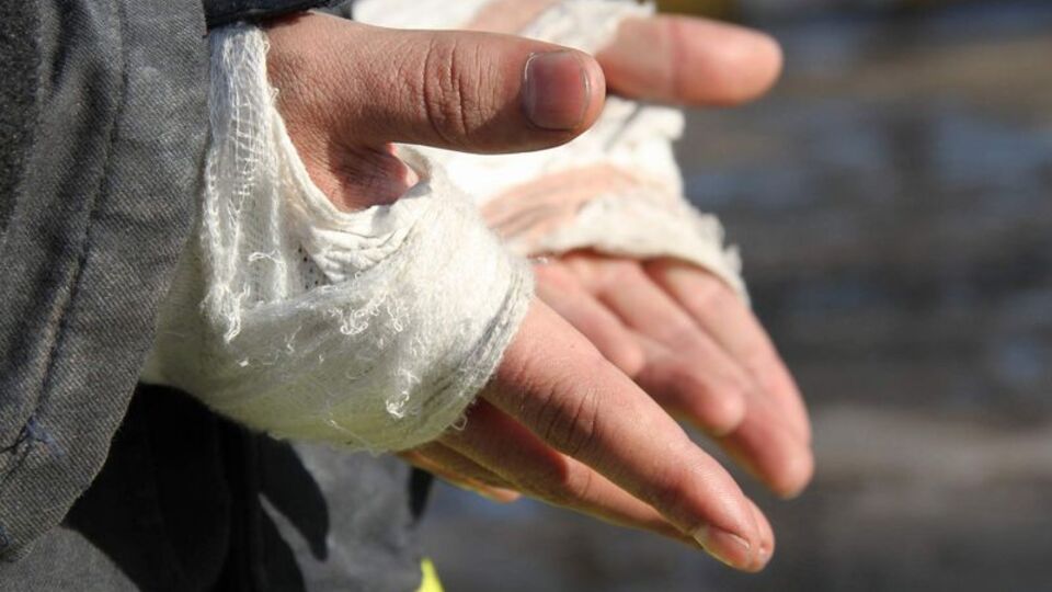 Pansuman nasıl yapılır?