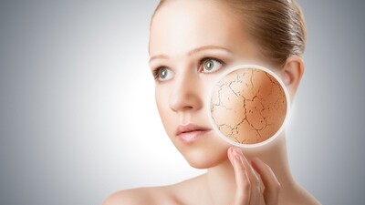 Cilt kuruluğunun nedenleri nelerdir?