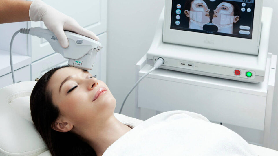 Ultherapy (ameliyatsız yüz germe) nedir?