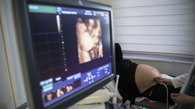 Bebeğin cinsiyeti ne zaman belli olur?