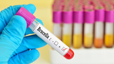 Brusella hastalığı nedir? Belirtileri nelerdir? Tedavisi var mıdır?