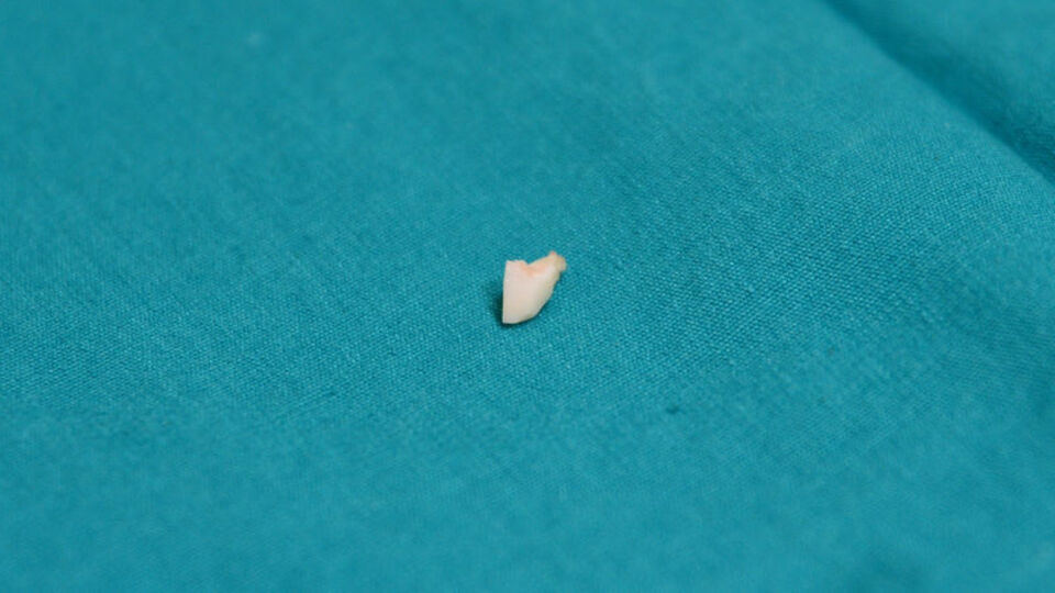 Akciğerine badem kaçtı!