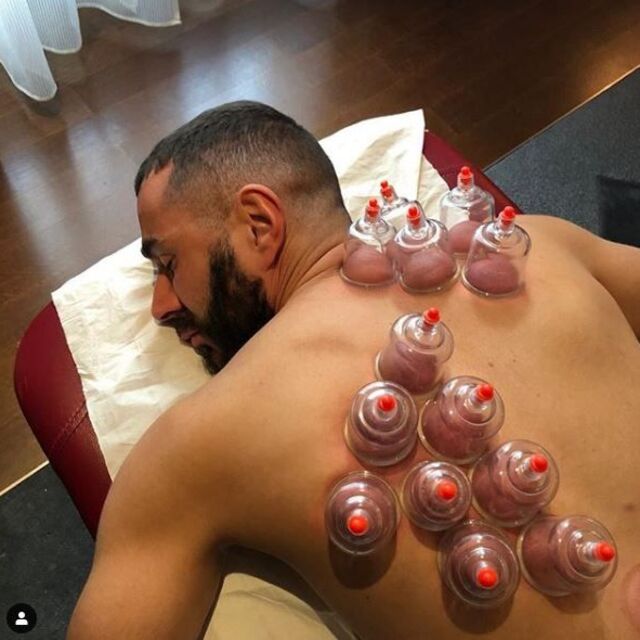 Karim Benzema hacamat yaptırdı