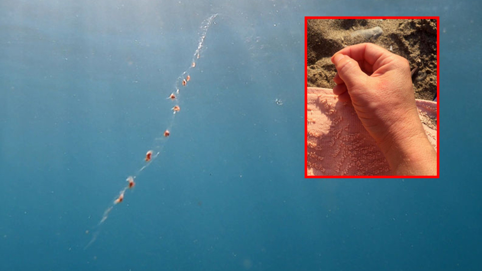 Elektrik akımına kapıldıklarını sandılar! İşte gerçek...