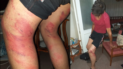 Triger kayışıyla dayakta tahliye