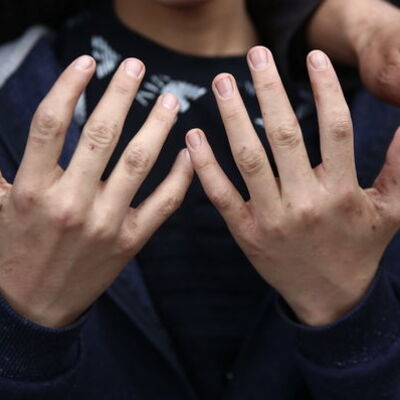 Salgın kapıda! Bu belirtilere dikkat!