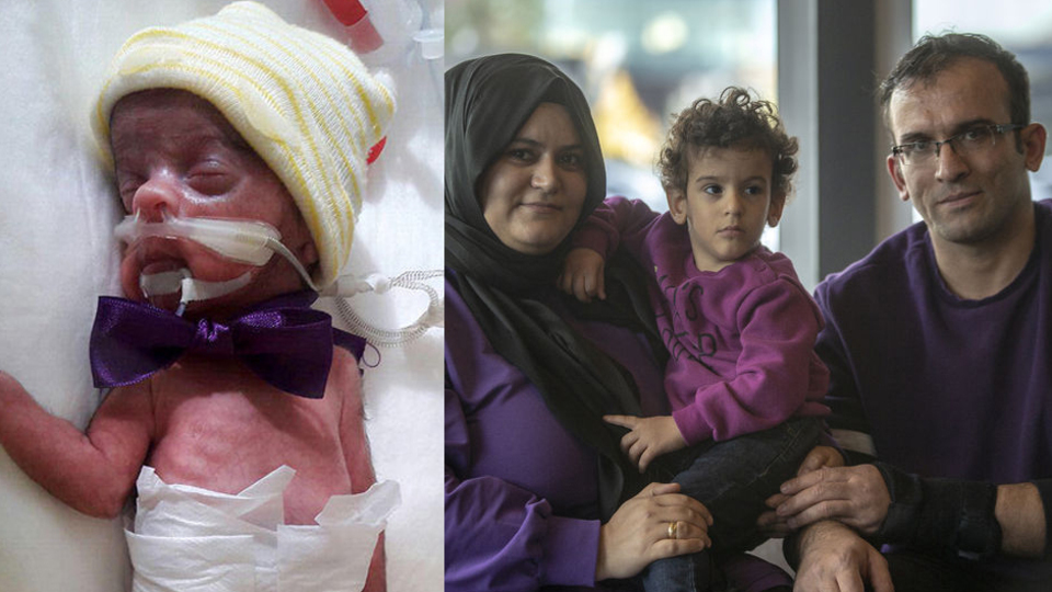 770 gram doğmuştu! İşte son hali...