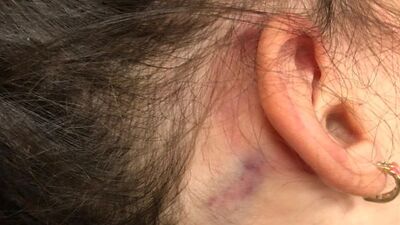 İnanamadılar! Kan kusunca ortaya çıktı, bunu yapanlar 2,5 yaşında...