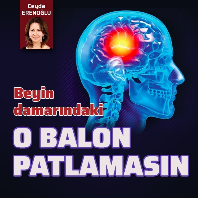 Beyin damarındaki o balon patlamasın!