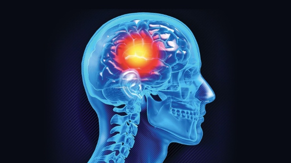 Beyin damarındaki o balon patlamasın!