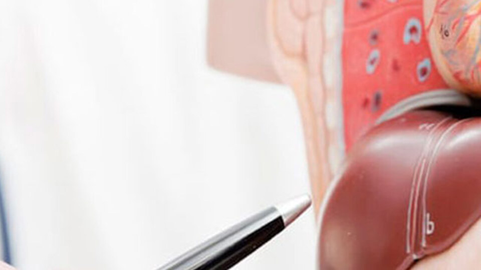 Siroz neden olur? Siroz nasıl teşhis edilir?