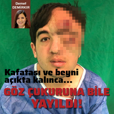 Göz çukuruna bile yayıldı! Kafatası ve beyni açıkta kalınca...