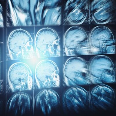 O kişilere 'felç' uyarısı