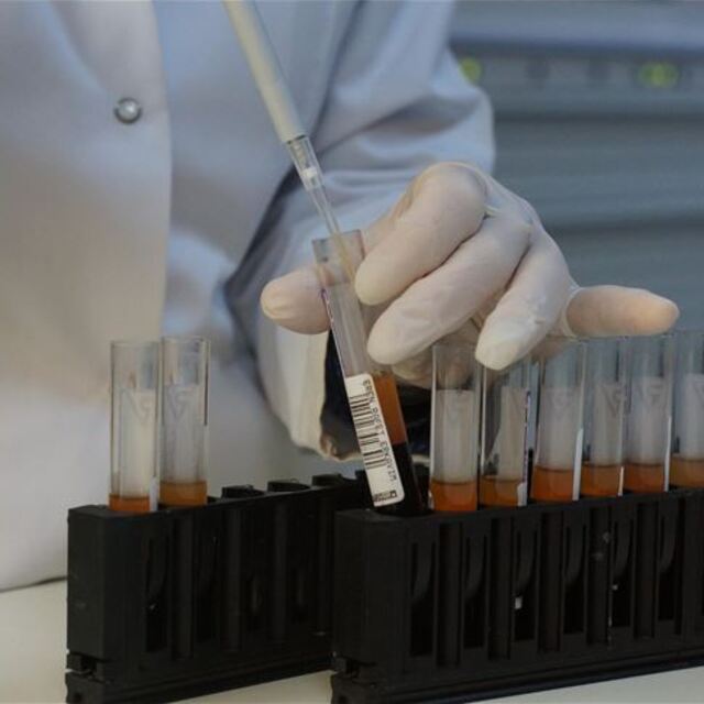 HIV'de 'dışlanma' teşhis ve tedaviyi engelliyor