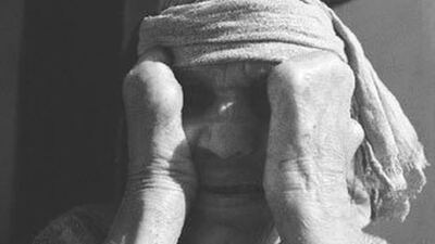 Cüzzam hastalığı belirtileri nelerdir?