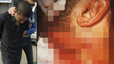 Doktora jiletli saldırıda şok ifade!