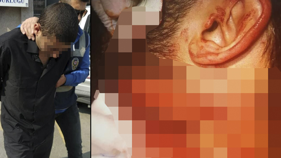 Doktora jiletli saldırıda şok ifade!