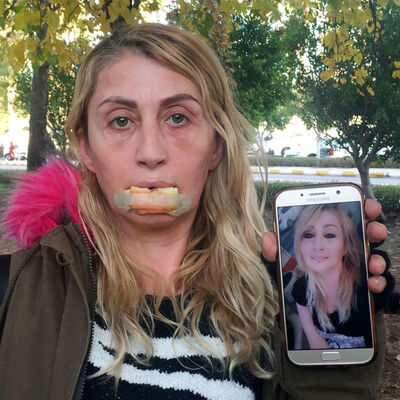 Güzellik uğruna hayatı karardı