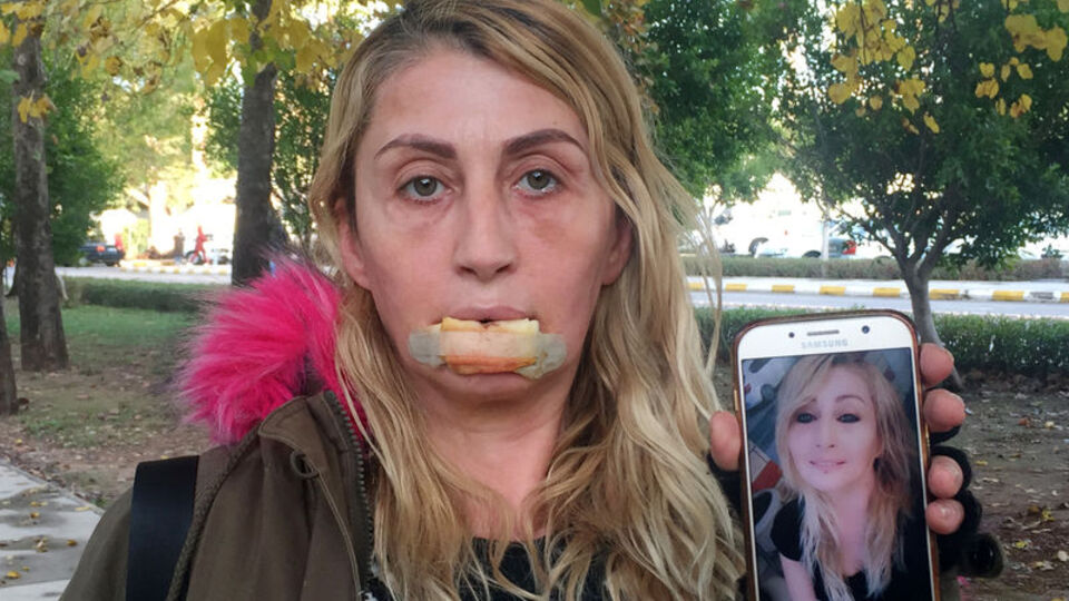 Güzellik uğruna hayatı karardı